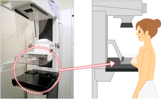 受けよう乳がん検診-マンモグラフィーとは｜特集｜eo健康